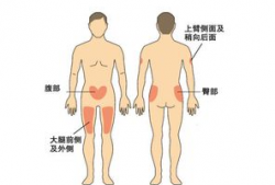 胰岛素打肚子视频教程,轻松掌握腹部注射技巧